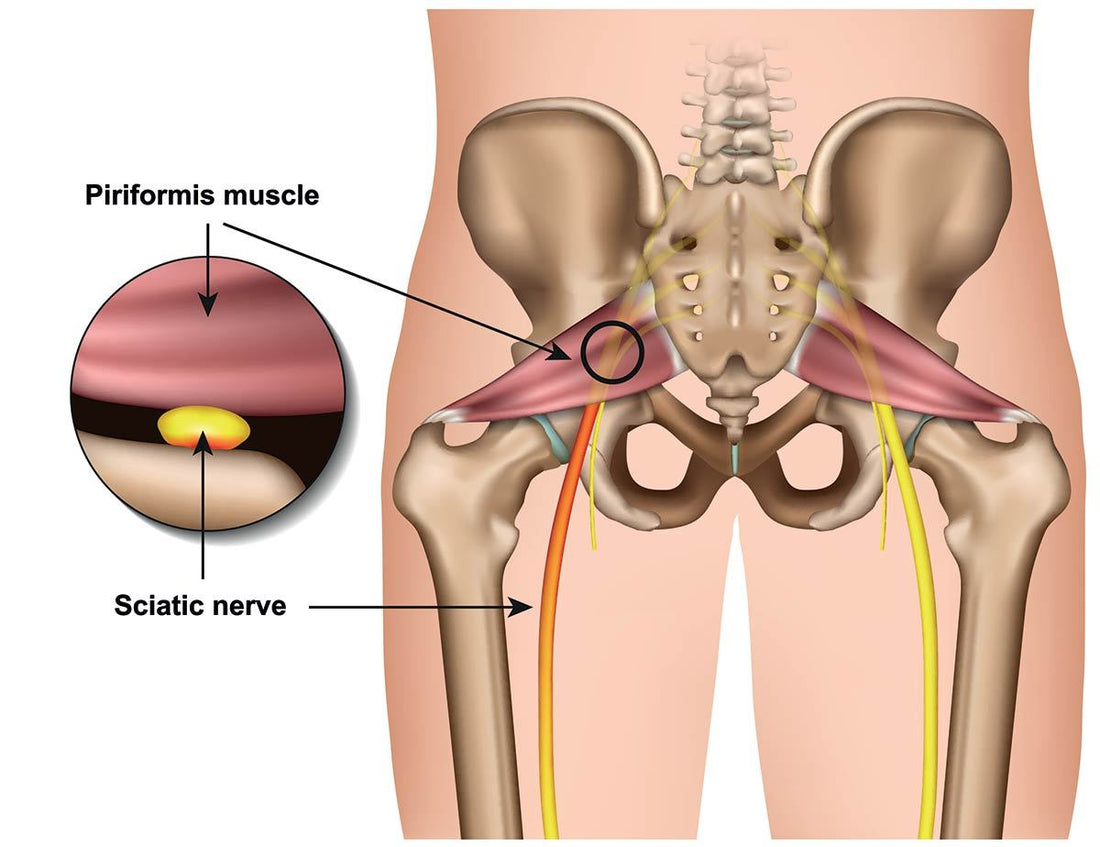 How Capsaicin Can Help Sciatica Pain