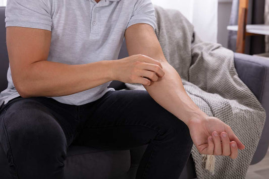 Treating shingles with capsaicin